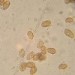 Sporen von Galerina marginata_1